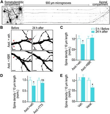 Unique Axon-to-Soma Signaling Pathways Mediate Dendritic Spine Loss and Hyper-Excitability Post-axotomy